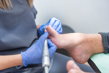 Professional podiatrist performing foot care treatment