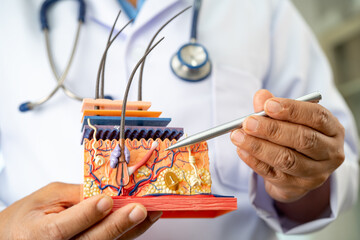 Asian dermatologist doctor holding skin structure model anatomy for treatment in hospital, hair transplant.