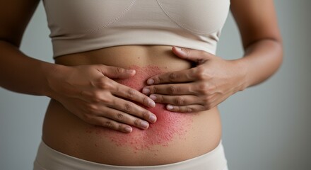 Woman with Red Irritated Skin Rash on Stomach
