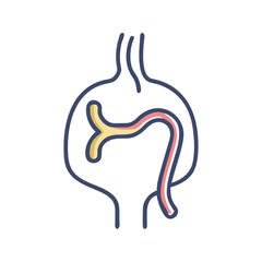 Endovascular Aneurysm Repair (EVAR) Procedure Graphic Illustration