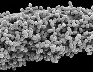 Willow pollen, SEM