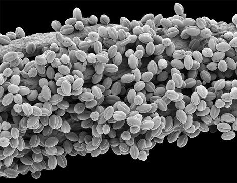 Willow pollen, SEM