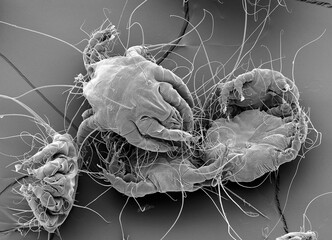 Dust mites, SEM