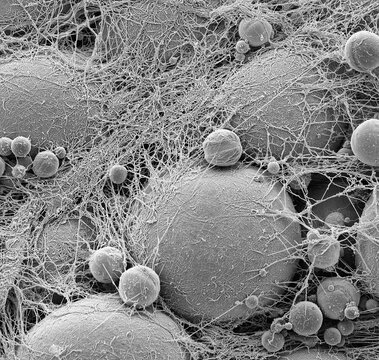 Fat cells, SEM