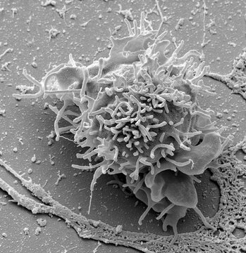 Natural killer (NK) cell, SEM
