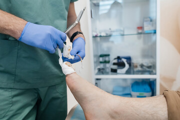 Resection of the nail plate, removal of ingrown nail. Dressing after surgery on the toe. Surgical treatment of onychocryptosis, paronychia and purulent disease
