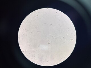 Calcium oxalate crystal in urine sediment.