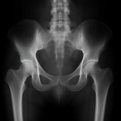 Human Body Bone Joint. full-body X-ray scan including the skull, spine, ribcage, and limbs. Health care concept