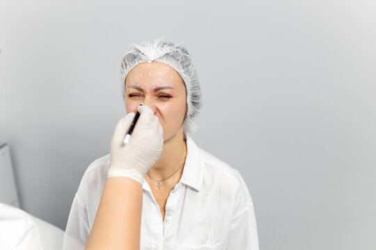 Close-up. Before the procedure for facial contouring or plastic surgery, the cosmetologist makes markings on the patient's face. Time to prepare for a cosmetic procedure