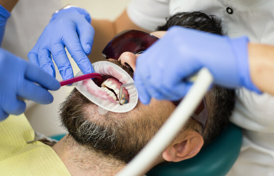 Dental care includes regular teeth whitening. Whitening procedure improves dental health and teeth. Dental hygiene starts with whitening teeth. Teeth look healthier after dental whitening.