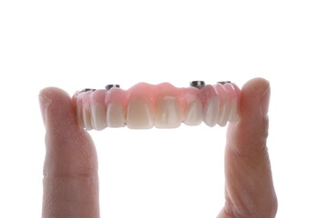 In dental implant surgery, the All-on-Four, All-on-4, and All-on-X treatments involve placing full-arch dental prostheses on cylindrical titanium implants applied to the upper jaw. Dental before after © UniqDream