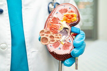 Kidney disease, Chronic kidney disease ckd, Doctor hold human model to treat and study in hospital.