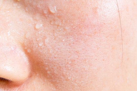Close-up of a woman's face sweating in the hot summer