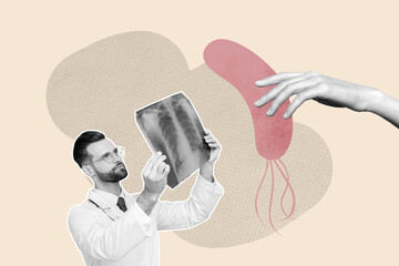Trend composite sketch 3D photo collage of young man hold xray examination lungs organ hospital...