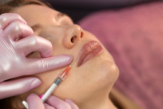 Aesthetician administers filler injection near patient's left nasolabial fold. Aesthetic cosmetology. Lip Augmentation. Female client during procedure in beauty clinic