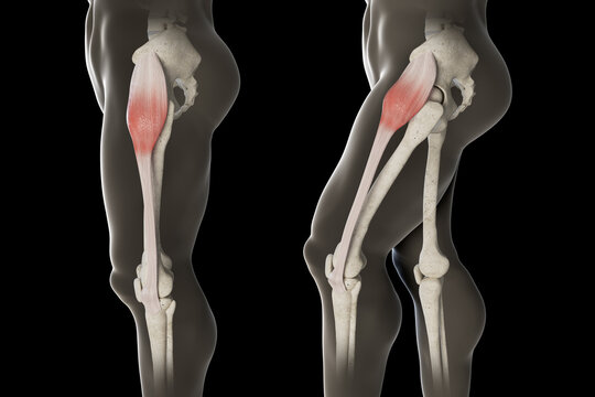 3d Illustration of Tensor Fasciae Latae Muscle Movement Side View