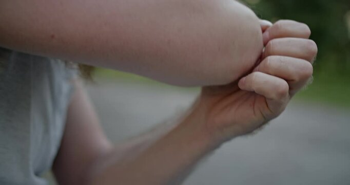 Close-up of a man scratching his itchy arm, highlighting dry skin, irritation, and discomfort. Perfect for healthcare and skincare campaigns.