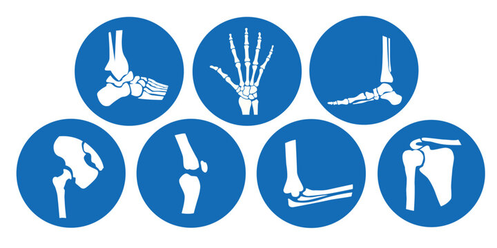Set of Orthopedic Icons in Blue Circles with White Bone and Joint Symbols, Flat Vector Illustration on Solid Background