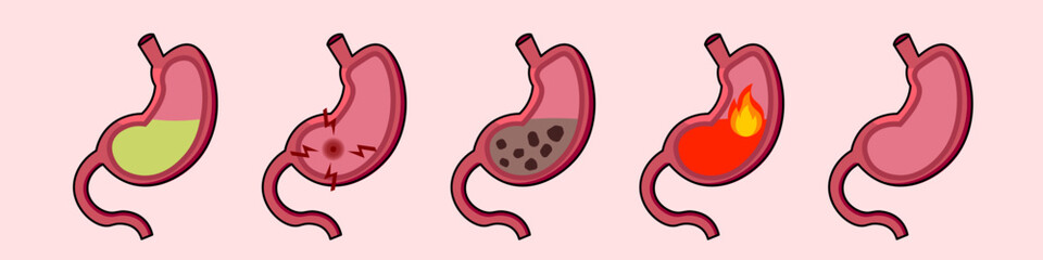 Stomach problems, heartburn, pain, ulcer, acidity, inflammation in the digestive system organ. Vector illustration