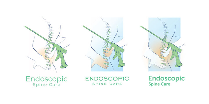 Endoscopic Spine Care Logo Design in Simple Line Art Style &ndash; Vector Illustration
