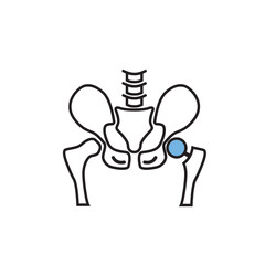 Arthroplasty line black icon. Hip replacement implant installed in the pelvis bone. Isolated vector element.