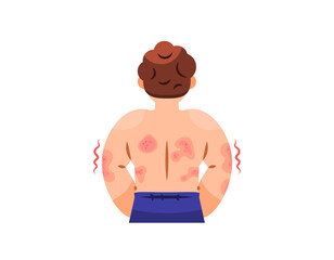illustration of a man facing back. back full of red rashes. symptoms of skin disease, Atopic Dermatitis, eczema, Psoriasis, Fungal Infection. health problem. flat style character design. elements