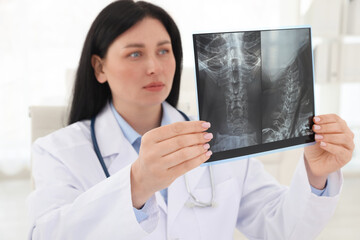 Doctor examining neck MRI scan in clinic
