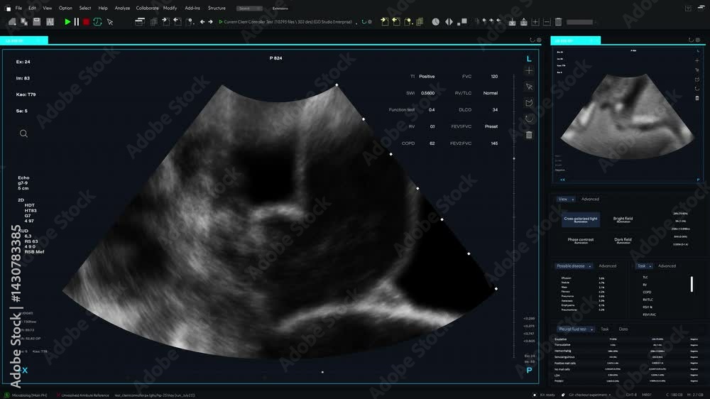 Poster ultrasound template with visible fetal movements and detailed anatomical visuals. screen replacement