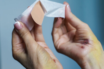 Women's hands with signs of trauma open a germicidal patch for first aid