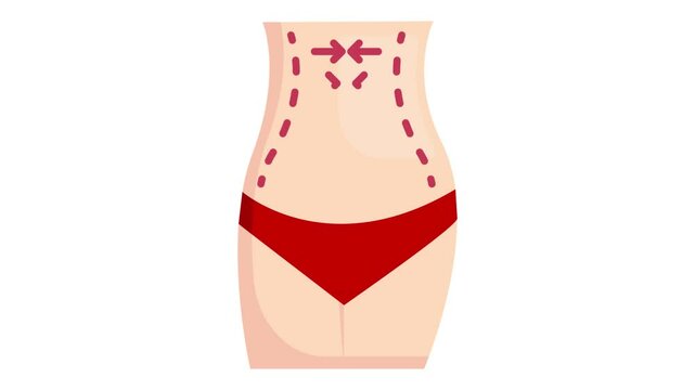 Liposuction Guidelines animation, noninvasive belly fat reduction direction animated video, beauty and personal care Clip, cosmetics and dermatologist footage, body aesthetics motion graphics