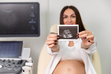 Happy young pregnant woman holding and showing ultrasound scan photo. Smiling mother with sonogram of her unborn baby. Concept of pregnancy. Maternity prenatal care.
