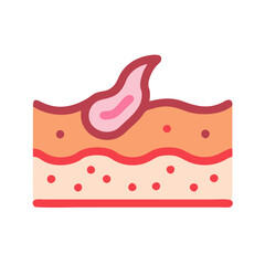 Skin Graft Illustration, Tissue Repair, Healing Wound Concept