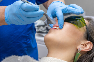 Treatment for tooth sensitivity. Dentist Performing Laser Procedure Inside Patient's Mouth