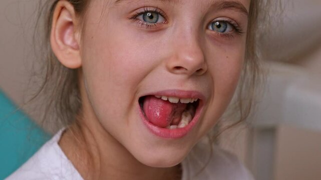 Little girl performs articulation exercises for mouth, concept of speech disorders, correction. Dentist, doctor examines oral cavity of small patient, length of frenum of the tongue. Motion footage