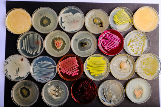 Multiple Bacterial Cultures Displaying Diverse 