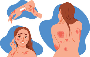Stressed woman with allergic itching, skin inflammation, redness and irritation. Upset girl suffer from itchiness and redness. Atopic dermatitis, eczema, psoriasis, dry skin. Skin diseases set. 