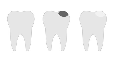 three healthy teeth caries filling on a white background,