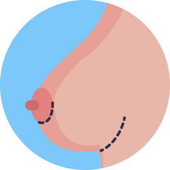 Visual representation of a breast implant procedure, often used to indicate augmentation or reconstructive surgery.