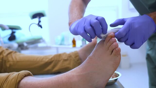 Resection of the nail plate, removal of ingrown nail. Dressing after surgery on the toe. Surgical treatment of onychocryptosis, paronychia and purulent disease