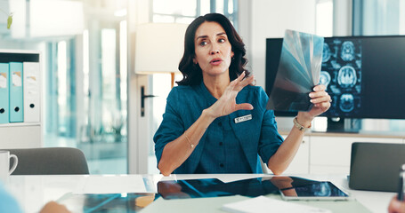 Brain, x ray and neurologist with woman in meeting for skull injury, research or tumor diagnosis in...