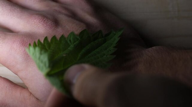 Stinging nettle rash timelapse. Close up of skin reacting to a stinging plant.