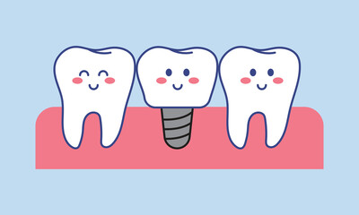 Dental implant character vector flat illustration. Cartoon teeth.