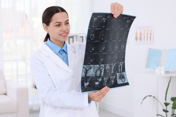 Doctor examining brain MRI scan in hospital