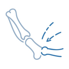 Elbow joint bone structure with arthritis indication