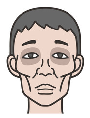 ヒポクラテス顔貌、痩せこけた男性の顔