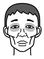 ヒポクラテス顔貌、痩せた男性の顔、白黒