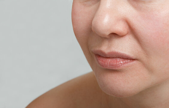 Close-up of Middle-Aged Woman with Deep Nasolabial Folds, Skin Aging Concept