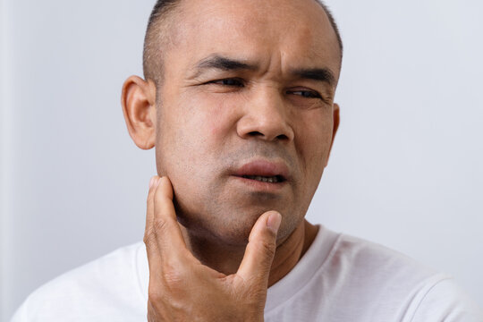The man has facial swelling due to an allergic reaction to triggers such as insect bites stings