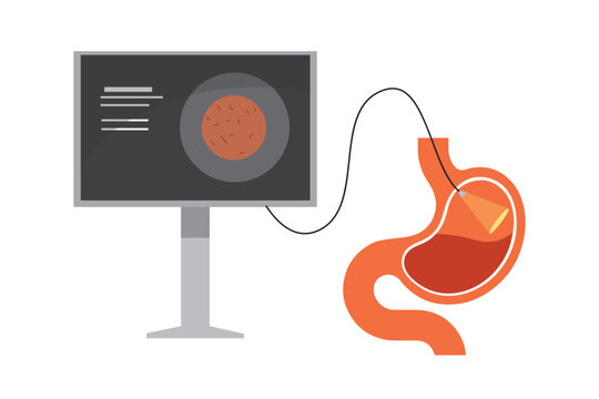 Endoscopy logo icon. Stomach gastroscopy cartoon gastritis medicine sign cancer egd system icon