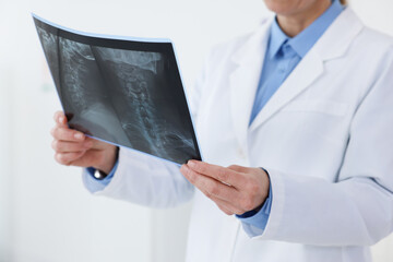 Doctor examining MRI scan in hospital, closeup